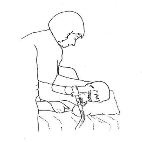 CPAP med hjælper i sideliggende.png