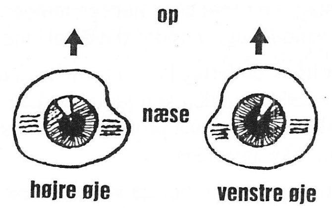 Behandling af øjenprotese_Placering.png