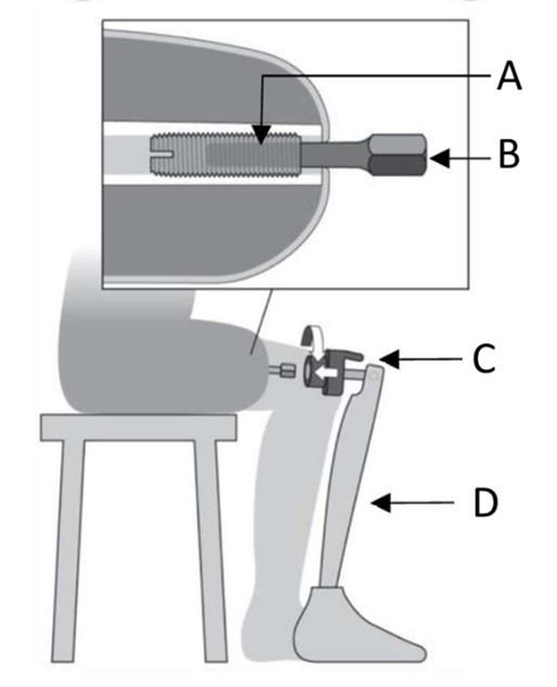 Osseointegreret protese på ben.jpg