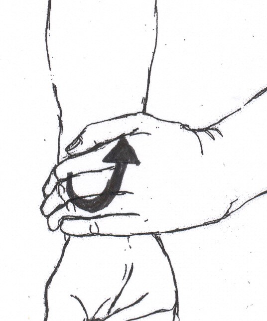 Genoptræning til patienter med vedværende hævelse i hånd og underarm