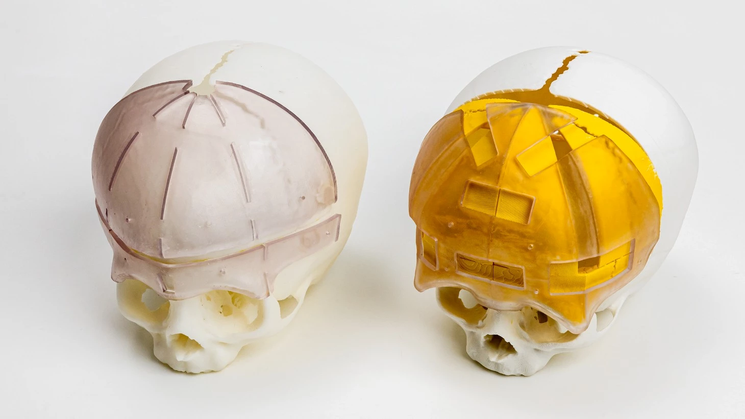 3D printede kranier