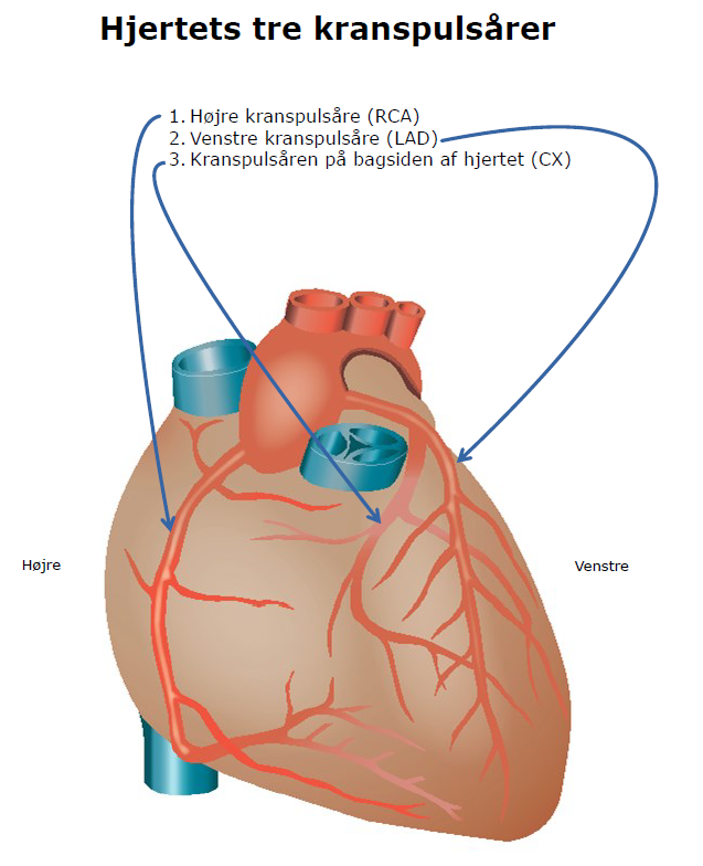 Hjertets tre kranspulsårer.png